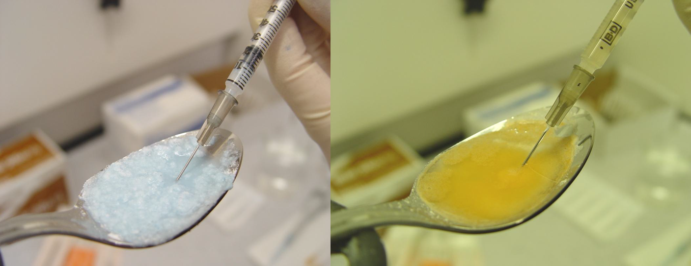 A collage of two photographs. On the left side there is a close-up of a person's hand holding a syringe with a needle inserted into it. The syringe is filled with a blue-colored substance. The background is blurred but it seems like the person is in a laboratory or laboratory setting.<br /><br />On the right side of the image there are two photographs side by side. The first photograph on the left shows the syringe being inserted into a spoon with a yellow liquid. The second photograph shows the same syringe but the liquid is still in the spoon. The spoon is resting on a white surface and there are some medical supplies visible in the background.