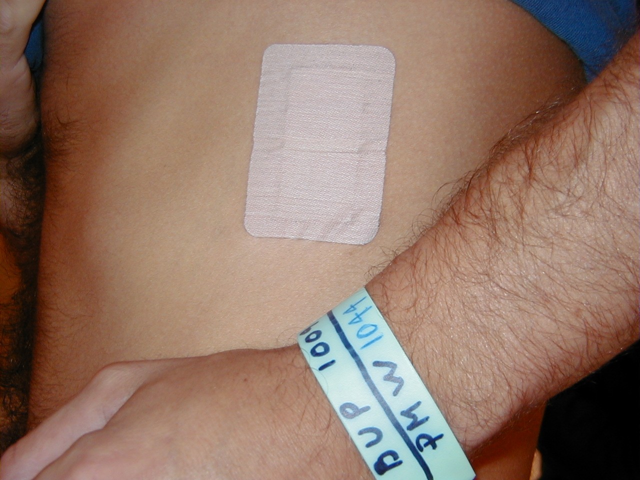 A close-up of a person's arm with a bandage on it. The bandage is rectangular in shape and appears to be made of a light-colored fabric. It is attached to the person's skin with a thin blue bandage. The person's hand is visible on the right side of the image with their fingers slightly curled around the bandage and their thumb is resting on their hip. The background is blurred so the focus is on the person and the bandages.