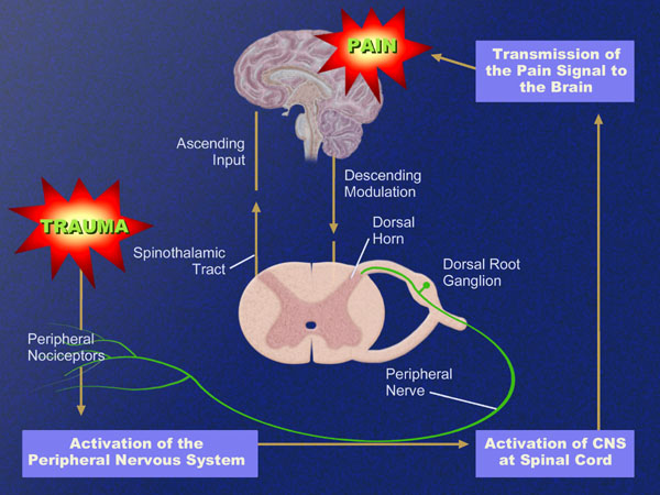 A diagram that shows the activation of the peripheral nervous system at the CNS at the spinal cord. It shows the process of the pain signal to the brain.<br /><br />The diagram is divided into two parts. The top part of the brain is labeled "Trauma" and shows the ascending input and descending modulation of the spinal nerve. The descending modulation is represented by a red star with the word "PAIN" written on it. The spinal nerve is shown as a pinkish-purple color and is located in the center of the image. <br /><br />There are two red stars on either side of the diagram one labeled "TRAUMA" and the other labeled "SPINTHALAMIC TACT". This indicates that the activation is caused by the presence of a spinal cord that is responsible for the pain in the brain which can be seen in the image as a red circle. The red star represents the signal that signals the pain while the green star represents a signal that is transmitted to the nerve which is represented as a green circle.<br />- The diagram also shows the peripheral nerves which are responsible for regulating the flow of blood and fluid in the nervous system. The peripheral nerves are shown as green circles which help to regulate the flow and regulate the movement of the nerves.