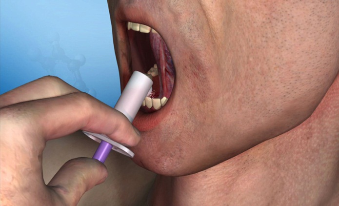 A 3D rendering of a close-up of a person with their mouth open revealing their teeth. The person's hand is holding a purple and white spray device (presumably) which is inserted into their mouth.