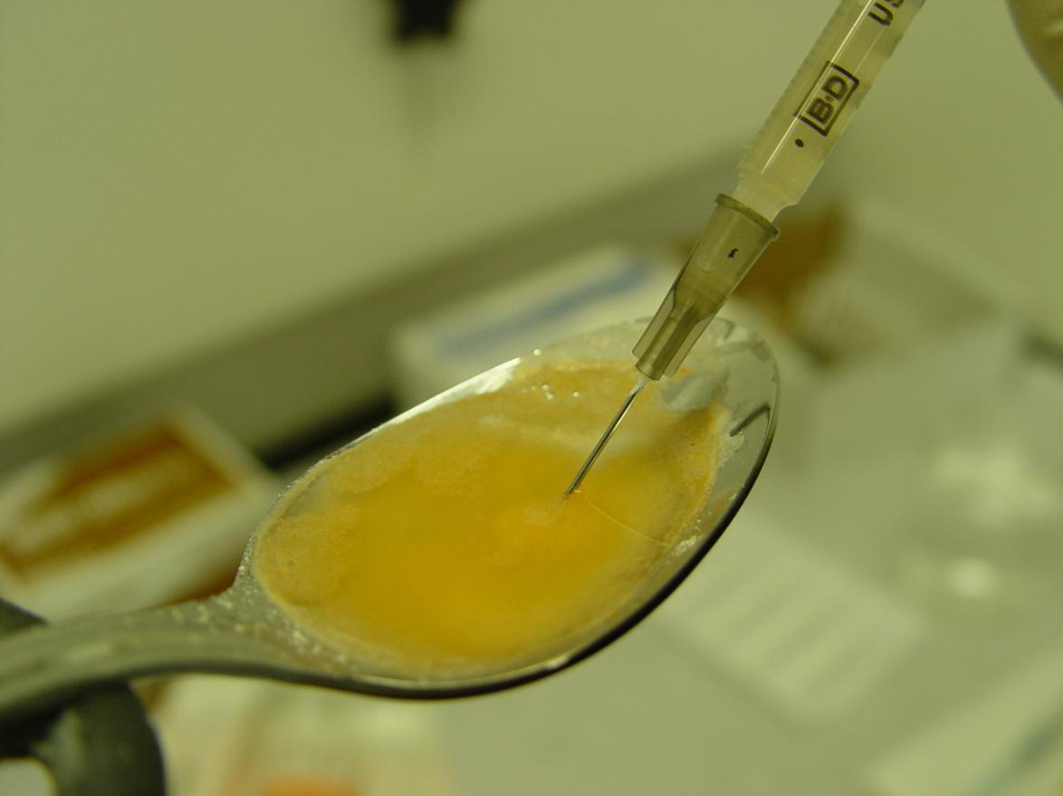 A close-up of a spoon with a syringe attached to it. The syringe has a needle inserted into the spoon which is filled with a yellow liquid. The liquid appears to be a mixture of orange and yellow colors. The spoon is resting on a white surface and there are some papers and other medical equipment visible in the background. The image is taken from a slightly elevated angle looking down on the spoon and the syringe.