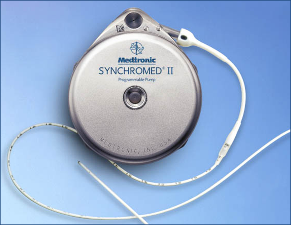 A medical device specifically a Medtronic Synchromed II which is a programmable pump. The device is silver in color and has a round shape with a handle on top for easy carrying. The body of the device is made of metal and has the brand name "Medtronic" written on it in blue letters. There is a small circular button on the front of the body which appears to be a control panel for adjusting the settings. A white cable is attached to the device which may be used to connect it to a monitor or other medical device. The background of the image is a light blue color.