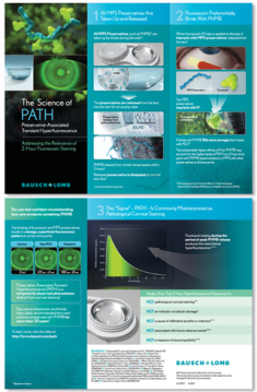 A set of three brochures from the brand Bausch+Lomb. The brochures are divided into three sections. <br /><br />The first section on the top left is titled "The Science of Path" and has an illustration of a green plant with a blue background. Below the illustration there is text that explains the benefits of the product. The text explains that the product is made with natural ingredients and is suitable for use in a variety of applications.<br /><br />In the middle section there are three smaller sections with information about the product including its features and benefits. The first section has an image of a plant with green leaves and a white background and the second section has a description of its benefits such as its ability to reduce inflammation improve digestion and reduce inflammation. The third section has information about how the product can help improve the overall health and wellbeing of the user. The fourth section has images of different types of food items including fruits vegetables and grains as well as a graph that shows the percentage of people who have been diagnosed with cancer.<br />- The brochure also has a brief description of each product and its benefits.