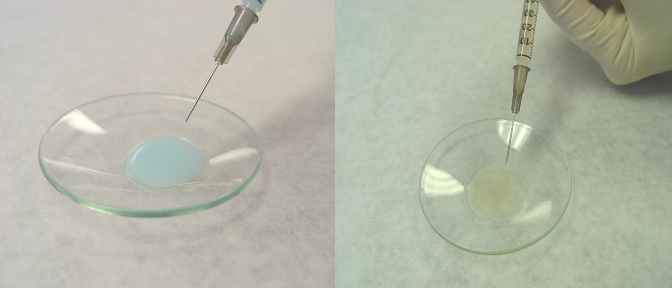 A collage of two photographs. On the left side there is a close-up of a syringe with a needle inserted into a clear glass bowl. The syringe is being held by a person's hand wearing a white glove. The background is a plain white surface.<br /><br />On the right side of the image there are two photographs side by side. The first photograph shows the syringe being inserted into the bowl while the second photograph shows a small amount of liquid being poured into the glass bowl which appears to be a light blue color. The liquid is not visible in both photographs.