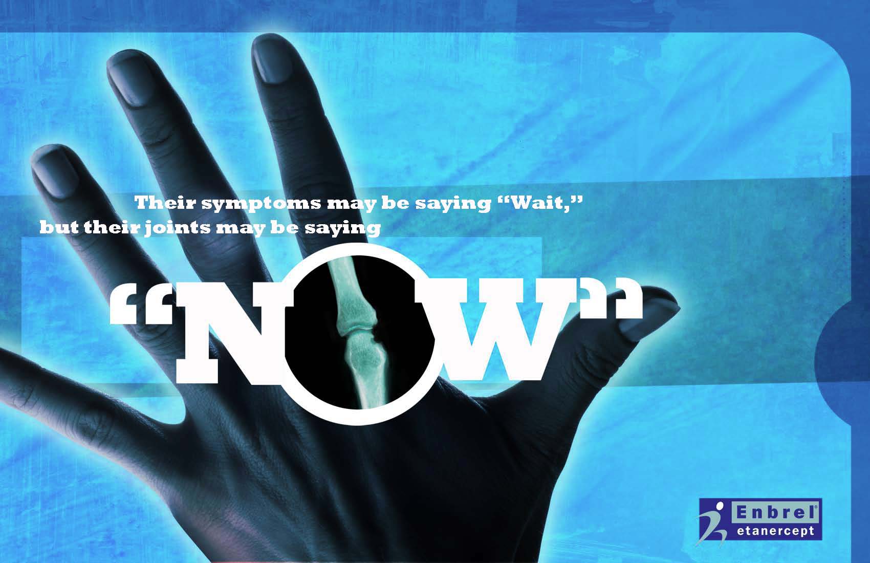 An advertisement for Enbrel (etanercept) with the tagline "Their symptoms may be saying 'Wait' but their joints may be saying 'Now'". The text is in a modern sans-serif font and is centered in the image over a blue background. It includes a picture of a human hand with an x-ray of one of the fingers (within the "o" of the word "Now"). The overall design is simple and minimalistic.