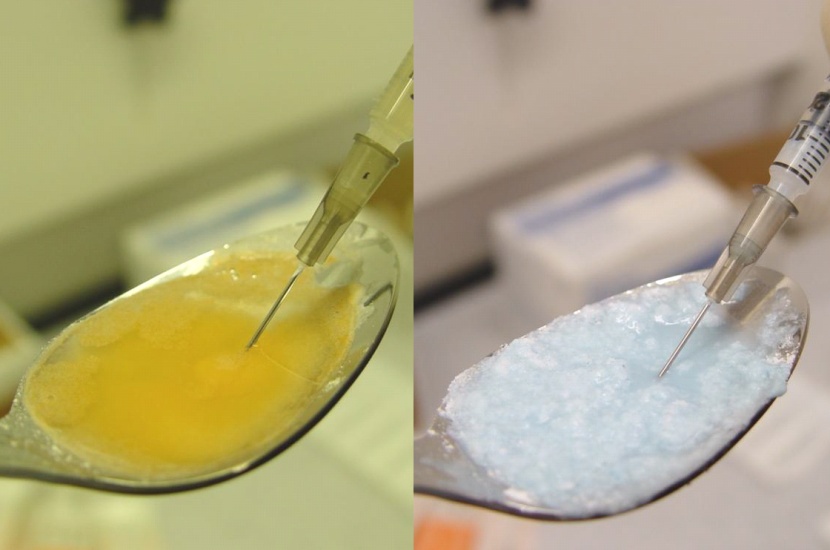 A collage of two photographs. On the left side there is a close-up of a spoon with a yellow liquid in it. The liquid appears to be a mixture of yellow and white colors. The spoon is resting on a white surface.<br /><br />On the right side of the image there are two syringes one with a needle and the other with a dropper. The needle is inserted into the yellow liquid and the dropper is holding a small amount of white substance. The background is blurred but it seems like the image was taken in a laboratory setting.