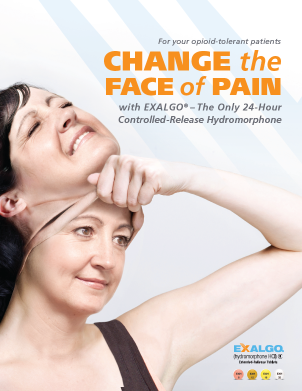 An advertisement for Exalgo with the tagline "Change the Face of Pain with EXALGO - The Only 24-Hour Controlled-Release Hydromorphone". The advertisement features a young woman with dark hair wearing a dark tank top who is touching her face. The background is white and blue with text in black and orange. The logo for Exalgo is in the bottom right corner.