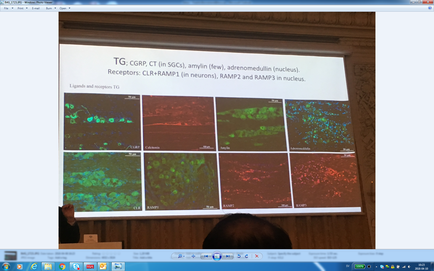 A screenshot of a presentation slide on a computer screen. The slide is titled "TG: carp CT (in SGS) amylin (few) adrenomodulin (nucleus) Receptors: CLR-ramp in neurons ramp and ramp in nucleus." The slide has multiple images of neurons in different colors including green blue red and orange. The images are arranged in a grid-like pattern with each image representing a different type of neuron. The background of the slide is white and there is a person's head visible in the bottom right corner of the image.