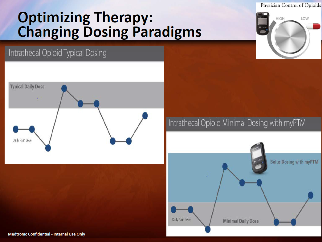 A slide from a presentation titled "Optimizing Therapy: Changing Dosing Paradigms". It is divided into two sections. <br /><br />On the left there is a line graph titled "Intrathecal Opioid Typical Dosing". It shows that the Typical Daily Dose is enough for the highest third of daily pain levels but is far too much for the other two-thirds of daily pain levels.<br /><br />On the right there is a line graph titled "Intrathecal Opioid Minimal Dosing with myPTM". It shows that Bolus Dosing with myPTM is enough for the highest 44% of daily pain levels and is only slightly too much for the other 56% of daily pain levels.