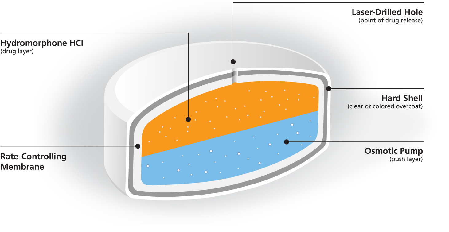 A cross-section of a tablet showing its various features and functions. The tablet has a white outer layer with a grey ring through it. Inside of the tablet is split into two layers orange on top and blue on the bottom. A hole is visible going through the grey and white outer layers to the orange layer. Various parts of the tablet are labeled. From outside in: The grey ring is labeled as "Hard shell (clear or colored overcoat). The white outer layer is labeled as "Rate-Controlling membrane". The hole is labeled as "Laser-Drilled Hole (point of drug release)". The orange layer is labeled "Hydromorphone HCI (drug layer)". The blue layer is labeled as "Osmotic pump (push layer)".