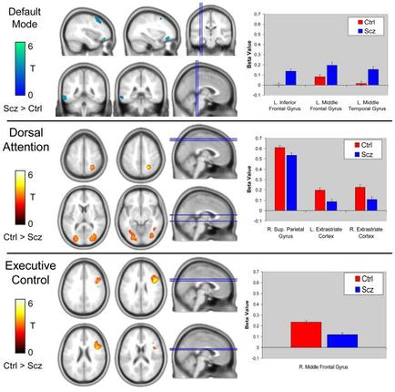 A collage of multiple MRI images of the brain showing the different areas of the head and neck. The images are arranged in a grid-like pattern with each image representing a different type of brain scan. The top left image shows the default mode of the scan which is represented by a bar graph. The top right image shows a bar chart with different colors representing different levels of brain activity. The bar graph shows that the scan is showing the percentage of people who have been diagnosed with Dorsal Attention which increases the number of patients who have experienced dorsal Attention in the brain. The chart also shows that there is a decrease in the percentage in the patient's brain activity over time. In the center of the image there are several images of different types of brain scans including the frontal temporal and temporal regions which are shown in red blue and green colors. The image also shows a red and blue bar graph which shows a decrease of the percentage. The red bar graph represents the percentage change in the number and the blue bar represents a decrease. The green bar represents an increase in percentage of patients' brain activity while the red and yellow bars represent the percentage changes in the overall mood of the patient. The blue and red bars represent a decrease with the red bar representing the highest percentage and the green bar representing a lower percentage.