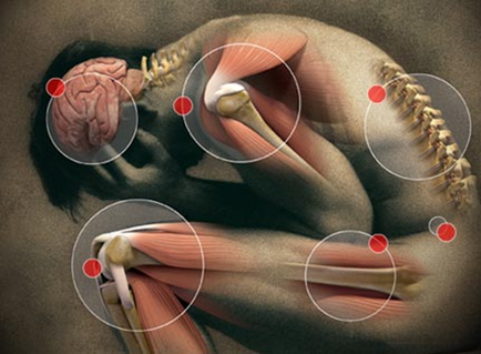 A digital illustration of a human body specifically the lower back and shoulder muscles. The image is divided into six circles each representing a different part of the human body. The first circle on the left side of the image shows the brain which is the main focus of the illustration. The brain is located in the top left corner and is surrounded by the muscles of the lower body. The muscles are arranged in a circular pattern around the brain and neck. In the center of the circle there is a large bone which appears to be the shoulder joint. The bone is located on the right side of this image and the muscles are highlighted in red circles. The background is a dark brown color which contrasts with the light-colored muscles and bones. The overall color scheme is predominantly beige and brown with some red circles scattered throughout the image.