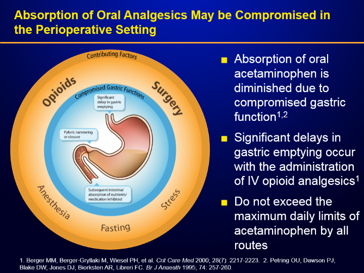 A slide from a presentation titled "Absorption of oral analgesics may be compromised in the perioperative setting". <br /><br />On the left side of the slide there are a series of concentric rings. The outer most ring is in dark orange and is labeled "Contributing factors". The next ring is light orange and has the words "Opioids" "Surgery" "Anesthesia" "Fasting" and "Stress" written in it. The next ring is dark blue and is labeled "Compromised Gastric Functions". The center of the circle is light blue and has an illustration of a human stomach. It includes three text boxes that note: significant delay in gastric emptying; pyloric narrowing or closure; and subsequent intestinal absorption of nutrients/medication inhibited.<br /><br />On the right side of the slide there are three bullet points with additional information. The first bullet point reads: "Absorption of oral acetaminophen is diminished due to compromised gastric function." The second bullet point reads: "Significant delays in gastric emptying occur with the administration of IV opioid analgesics." The third bullet point reads: "Do not exceed the maximum daily limits of acetaminophen by all routes." <br /><br />There are a number of citations at the bottom of the page.