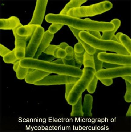 A scanning electron micrograph of Mycobacterium tuberculosis. It shows a group of green-colored bacteria which appear to be elongated and elongated. The bacteria are arranged in a cluster with some overlapping each other. The background is black which contrasts with the bright green color of the bacteria. The image is taken from a close-up perspective allowing us to see the intricate details of the structure. The text on the image reads "Scanning Electron Micrograph" and "Mycobacteria tuberculosis".