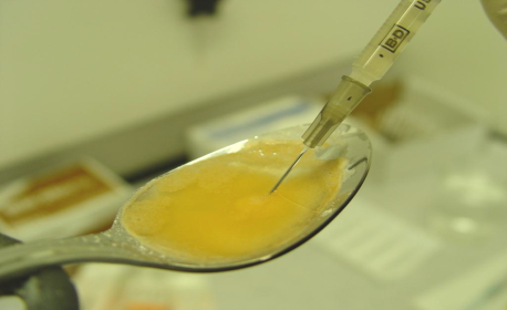 A close-up of a spoon with a syringe attached to it. The syringe has a needle inserted into the spoon which is filled with a yellow liquid. The liquid appears to be a mixture of orange and yellow colors. The spoon is resting on a white surface and there are some medical supplies visible in the background. The image is taken from a slightly elevated angle looking down on the spoon and the syringe.