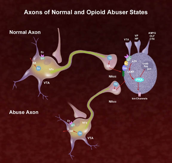 A diagram that is titled "Axons of  normal and opioid abuser states". It shows two axons one labeled "Normal Axon" and the other labeled "Abuse Axon".