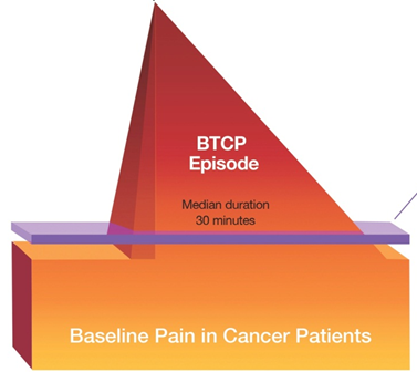 A pyramid-shaped diagram that represents the baseline pain in cancer patients. The pyramid is divided into three sections - the top section is red the middle section is orange and the bottom section is purple. The red section has the words "BTCP Episode" written on it indicating that it is a podcast episode. The orange section has a label that reads "Median duration 30 minutes". The purple section is labeled "Baseline Pain in Cancer Patients". The diagram also has an arrow pointing to the bottom of the pyramid indicating the direction of the pain. The background of the image is white.