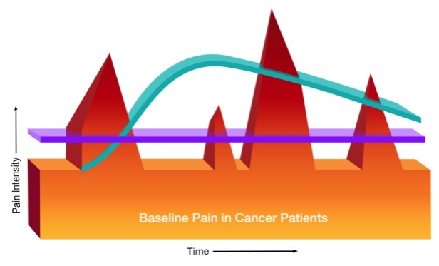 A graph that shows the relationship between baseline pain in cancer patients and pain intensity. The graph is divided into three sections each representing a different stage of the pain.<br /><br />The first section is labeled "Pain Intensity" and shows a red triangle on the left side of the graph. The second section is titled "Baseline Pain in Cancer Patients" and has a blue line that goes from the top left corner to the bottom right corner. The third section is labeled "Time" and is represented by a purple line. The blue line represents the pain intensity of the patients while the red line represents pain intensity from the bottom left corner indicating that the pain is higher than the blue line. <br /><br />Overall the graph shows that baseline pain can be caused by a variety of factors such as pain inflammation and inflammation in the body and that it can affect the overall health and well-being of those affected by cancer patients.