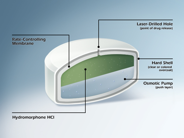 A cross-section of a hydromorphone HCI (Hydromorphone HCI) membrane which is a type of membrane used in medical applications. The image shows the structure of the membrane including the rate-controlling membrane laser-drilled hole (point of drug release) hard shell (clear or colored overcoat) and osmotic pump (push layer). <br /><br />The membrane is shown in a circular shape with a green and blue color scheme. The outermost part of the image shows a layer of water which appears to be a greenish-blue color with small white dots scattered throughout. The innermost part is a white oval-shaped structure with a hole in the center. The hole is labeled with the words "Laser-Drilled Hole" and "Hard Shell" in black text.<br /><br />There is also a label on the right side of the diagram that reads "Osmotic Pump (Push layer)". This indicates that the membrane is used to control the flow of water through the membrane.