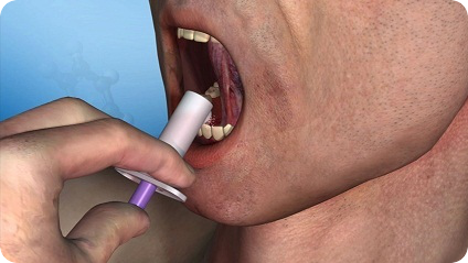 A close-up of a person's mouth with their mouth open and their teeth visible. The person is holding a syringe in their right hand which is inserted into their mouth. The syringe is white and purple in color and appears to be filled with a liquid. The background is a light blue color and the person's skin is visible on the right side of the image. The image is a 3D rendering giving it a realistic and lifelike appearance.