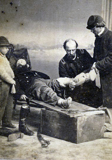 A black and white photograph of a group of men in a room. The photograph appears to be from the early 20th century. It shows a man lying on a wooden bench with his legs stretched out in front of him. He is wearing a suit and tie and has a serious expression on his face.<br /><br />On the left side of the image there is a young boy wearing a hat and holding a cane. He seems to be looking at the man lying down with a concerned expression. On the right side there are two men one of whom is holding a pair of scissors and the other is examining the man's leg. The man on the left is standing next to the bench looking at him with a worried expression. The other man is standing behind the bench and is looking down at the ground. The background is a plain wall with a window and a curtain.