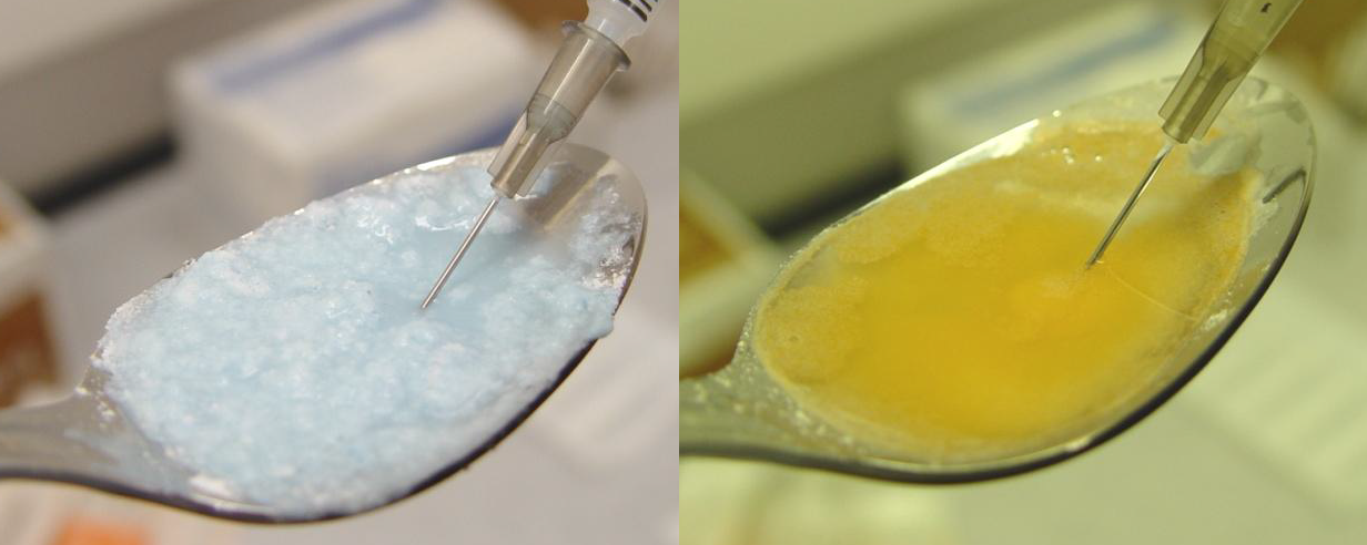 This image is a collage of two identical photographs. The image shows a spoon filled with a light  substance likely heroin or another drug and a syringe. The syringe drawing up the substance.  The background is blurred but it appears to be  laboratory setting. The photo on the left has a neutral tint and the substance looks light blue. The photo on the right appears to have a yellow filter and the substance looks more liquid and is a shade of yellow.