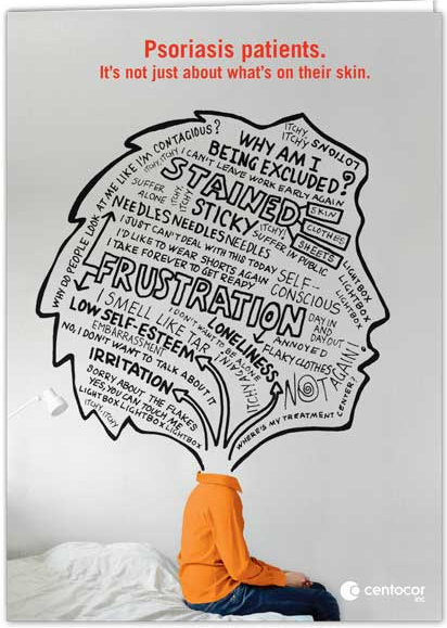 A person sitting on a bed with their head in their hands. The person is wearing an orange hoodie and is facing away from the camera. The background is white and there is a large black and white illustration of a tree-like structure in the center of the image. The tree is made up of various words and phrases written in different sizes and colors. The words are arranged in a way that they form the shape of a brain with the words "Psoriasis patients" and "It's not just about what's on their skin" written above and below the tree. The phrases include "Why am I being excluded?" "Stained" "Sticky" "Frustration" "Low self-esteem" "Irritation" and "Not". The overall tone of the illustration is humorous and lighthearted.