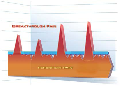 A graph that shows the relationship between breakthrough pain and persistent pain. The graph is divided into three sections each representing a different type of pain.<br /><br />The first section is orange representing the strength of the pain while the second section is blue representing the pain itself. The red sections are arranged in a vertical line with the peaks of the peaks reaching upwards towards the top of the graph. The peaks are labeled with the words "Breakthrough Pain" and "Persistent Pain."<br /><br />There are also three red triangles on the graph representing strength and stability. The first triangle is labeled "PERSISTENT PAIN" indicating that the pain is higher than the other three. The second triangle is labeled "PERSONAL PAIN". The third triangle is marked with a blue line indicating that it is higher in strength. The background of the image is white and the graph is colored in shades of orange and blue.