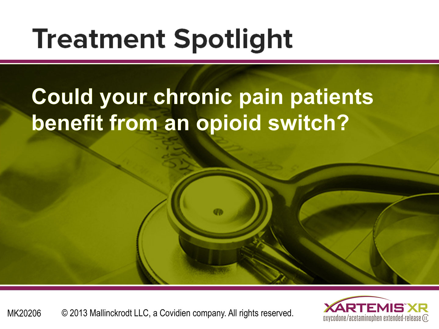 A graphic design with a green background and white text. The text reads "Treatment Spotlight: Could your chronic pain patients benefit from an opioid switch?" The text is in a bold sans-serif font and is centered on the image. On the right side of the image there is a close-up of a stethoscope resting on top of a medical chart. The image also has a logo for XARTEMIS XR.