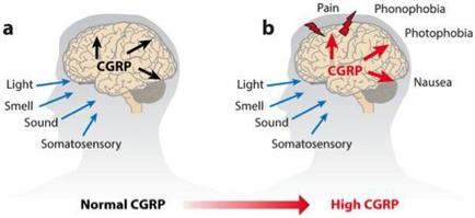 A diagram that shows the difference between normal and high carp (High corps) in the brain. On the left side of the image there is a brain labeled "a" with the letters "carp" written on it. The brain is labeled "light" "smell" "sound" and "somatosensory". On the right side there are two arrows pointing towards the brain one labeled "pain" "photophobia" "photophobia" and the other labeled "nausea". The arrows indicate that the image is meant to illustrate the effects of light on the brain and how it affects the mood. The image also has a red arrow pointing to the right indicating the direction of the light. This suggests that the light is emitted from the brain to the sound which can be seen in the image.