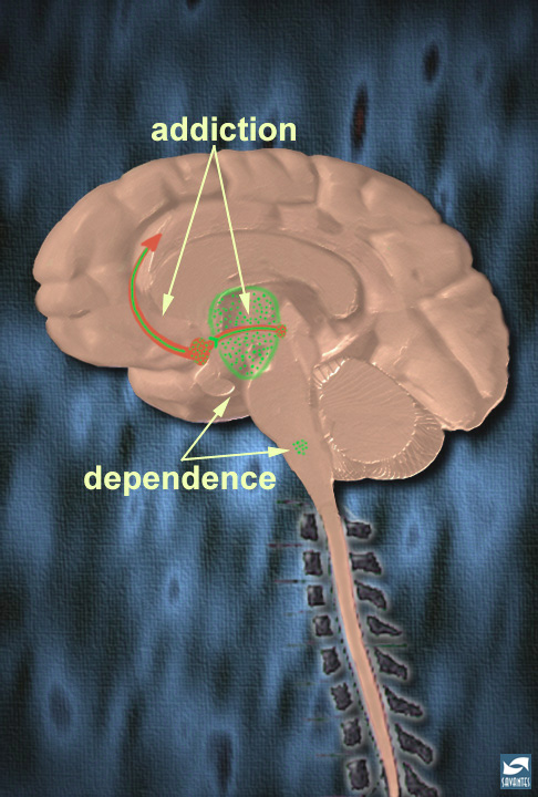 An illustration of the human brain including the brainstem and the upper spine. The brain and brainstem are shown in a light pink color. An arrow shaped object is illustrated in red curving from the center of the brain up to the top left. An egg-shaped object is illustrated in green at the center of the brain. The red arrow shaped object passes through the green egg shaped object. There is also a small green spot at the top of the brainstem. <br /><br />The word "addiction" has two arrows pointing to the red arrow shaped object in two places where it intersects with the green object and where it curves upward. The word "dependence" has two arrows pointing from it to both of the green objects. <br /><br />The image is set against a dark blue background and has a textured appearance.